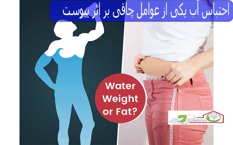 احتباس آب یکی از عوامل چاقی بر اثر یبوست